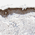 STK40 Antibody in Immunohistochemistry (Paraffin) (IHC (P))