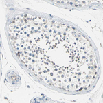 STK40 Antibody in Immunohistochemistry (Paraffin) (IHC (P))
