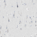 STK40 Antibody in Immunohistochemistry (Paraffin) (IHC (P))