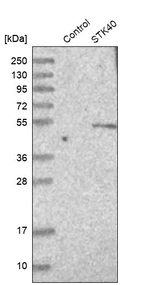 STK40 Antibody in Western Blot (WB)
