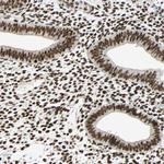 CDK12 Antibody in Immunohistochemistry (Paraffin) (IHC (P))