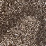 CDK12 Antibody in Immunohistochemistry (Paraffin) (IHC (P))