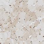 CDK12 Antibody in Immunohistochemistry (Paraffin) (IHC (P))