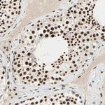 CDK12 Antibody in Immunohistochemistry (Paraffin) (IHC (P))