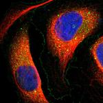 TMEM166 Polyclonal Antibody