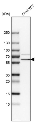 alpha Internexin Antibody in Western Blot (WB)