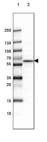 alpha Internexin Antibody in Western Blot (WB)
