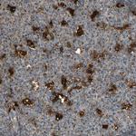 GM2A Polyclonal Antibody