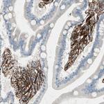 Caldesmon Antibody in Immunohistochemistry (Paraffin) (IHC (P))