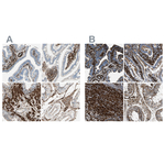 Caldesmon Antibody in Immunohistochemistry (Paraffin) (IHC (P))