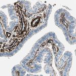 Caldesmon Antibody in Immunohistochemistry (Paraffin) (IHC (P))