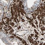 Caldesmon Antibody in Immunohistochemistry (Paraffin) (IHC (P))