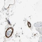 Caldesmon Antibody in Immunohistochemistry (Paraffin) (IHC (P))