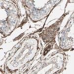 Caldesmon Antibody in Immunohistochemistry (Paraffin) (IHC (P))