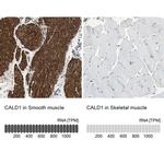Caldesmon Antibody