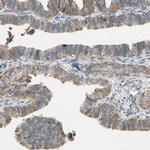 LIMK2 Antibody in Immunohistochemistry (Paraffin) (IHC (P))