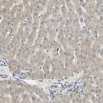 LIMK2 Antibody in Immunohistochemistry (Paraffin) (IHC (P))