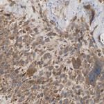 LIMK2 Antibody in Immunohistochemistry (Paraffin) (IHC (P))