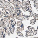 LIMK2 Polyclonal Antibody