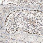 LIMK2 Antibody in Immunohistochemistry (Paraffin) (IHC (P))
