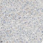 EphB3 Antibody in Immunohistochemistry (Paraffin) (IHC (P))