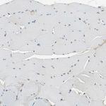 EphB3 Antibody in Immunohistochemistry (Paraffin) (IHC (P))