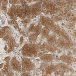 EphB3 Antibody in Immunohistochemistry (Paraffin) (IHC (P))