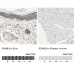 EphB3 Antibody