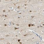 NPDC1 Antibody in Immunohistochemistry (Paraffin) (IHC (P))