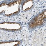 NPDC1 Antibody in Immunohistochemistry (Paraffin) (IHC (P))