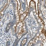 NPDC1 Antibody in Immunohistochemistry (Paraffin) (IHC (P))
