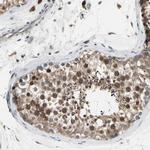 MMEL1 Polyclonal Antibody