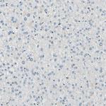 OXSR1 Antibody in Immunohistochemistry (Paraffin) (IHC (P))