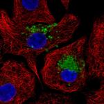 MUC5B Polyclonal Antibody