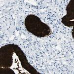 MUC5B Antibody in Immunohistochemistry (Paraffin) (IHC (P))