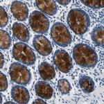 MUC5B Antibody in Immunohistochemistry (Paraffin) (IHC (P))