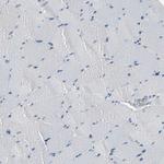 MUC5B Antibody in Immunohistochemistry (Paraffin) (IHC (P))