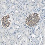 TGFBR3 Antibody in Immunohistochemistry (Paraffin) (IHC (P))