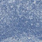 TGFBR3 Antibody in Immunohistochemistry (Paraffin) (IHC (P))