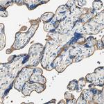 TGFBR3 Antibody in Immunohistochemistry (Paraffin) (IHC (P))