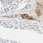 TGFBR3 Antibody in Immunohistochemistry (Paraffin) (IHC (P))