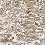 PDK2 Antibody in Immunohistochemistry (Paraffin) (IHC (P))