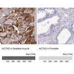alpha Actinin 2 Antibody