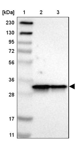 ARPC2 Antibody in Western Blot (WB)