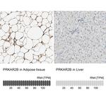 PRKAR2B Antibody