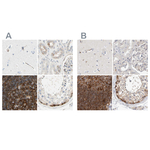 NFkB p100 Antibody in Immunohistochemistry (Paraffin) (IHC (P))