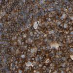 NFkB p100 Antibody in Immunohistochemistry (Paraffin) (IHC (P))