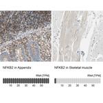 NFkB p52 Antibody