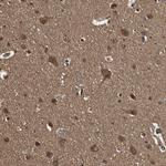 14-3-3 epsilon Polyclonal Antibody