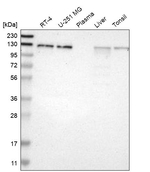 EPS15 Antibody in Western Blot (WB)